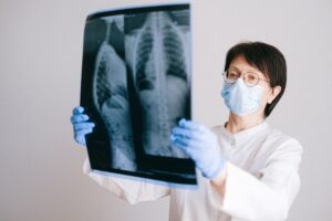 lungs xray